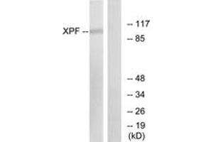 Western Blotting (WB) image for anti-Excision Repair Cross-Complementing Rodent Repair Deficiency, Complementation Group 4 (ERCC4) (AA 801-850) antibody (ABIN2889291) (ERCC4 antibody  (AA 801-850))