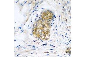 Immunohistochemical analysis of Neuroligin Y staining in human prostate formalin fixed paraffin embedded tissue section. (Neuroligin Y antibody)