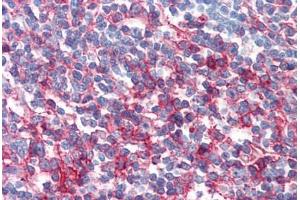 Human Tonsil (formalin-fixed, paraffin-embedded) stained with FAS antibody ABIN351542 at 10 ug/ml followed by biotinylated anti-mouse IgG secondary antibody ABIN481714, alkaline phosphatase-streptavidin and chromogen. (FAS antibody)