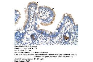 Human Intestine (RNF39 antibody  (N-Term))