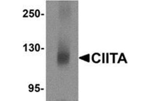 Western blot analysis of CIITA in mouse brain tissue lysate with CIITA antibody at 1 μg/ml. (CIITA antibody  (N-Term))