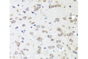 Immunohistochemistry of paraffin-embedded Mouse brain using IGFBP5 Polyclonal Antibody at dilution of 1:100 (40x lens).