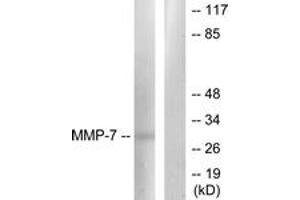 Western blot analysis of extracts from COS7 cells, using MMP-7 Antibody.
