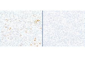 Immunohistochemistry (IHC) image for anti-gamma Histone Variant H2AX (GAMMA-H2AX) (Ser140) antibody (ABIN7449557) (gamma H2AX antibody  (Ser140))