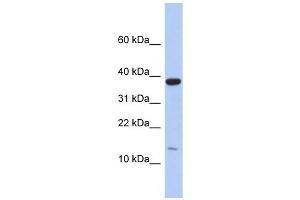RPL27 antibody used at 1 ug/ml to detect target protein. (RPL27 antibody  (Middle Region))