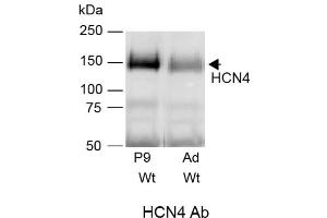 Immunoblots of membrane-enriched fraction from adult (Ad) and 9 (P9) or 11 (P11) postnatal days Wt and Sarm1-/- mice probed with anti-HCN4 (cat.