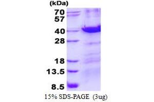 Image no. 1 for Methyl-CpG Binding Domain Protein 3 (MBD3) protein (His tag) (ABIN1098411)