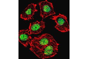 Fluorescent confocal image of  cell stained with p53 Antibody  h. (p53 antibody  (AA 293-322))