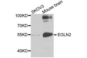 Western blot analysis of extracts of various cell lines, using EGLN2 antibody. (PHD1 antibody  (AA 150-250))