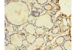 Immunohistochemistry of paraffin-embedded human thyroid tissue using ABIN7175757 at dilution of 1:100 (WDR49 antibody  (AA 251-500))