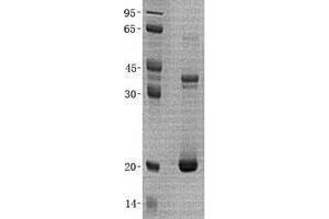 Validation with Western Blot (VSNL1 Protein (His tag))