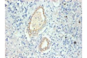 Immunohistochemical of paraffin-embedded human kidney tissue using ABIN7152614 at dilution of 1:200 (FABP3 antibody)