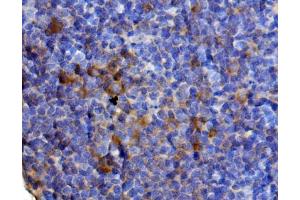 IHC analysis of Il13 using anti-Il13 antibody (ABIN7600672). (IL-13 antibody  (AA 22-131))