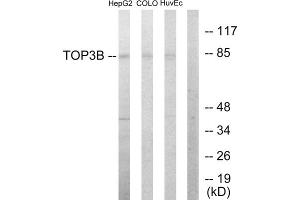 Western blot analysis of extracts from HepG2 cells, COLO205 cells and HUVEC cells, using TOP3B antibody. (TOP3B antibody  (N-Term))
