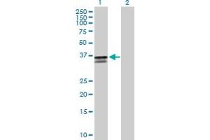 Western Blot analysis of ST3GAL2 expression in transfected 293T cell line by ST3GAL2 MaxPab polyclonal antibody. (ST3GAL2 antibody  (AA 1-350))