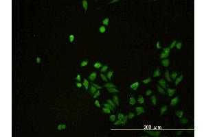 Immunofluorescence of monoclonal antibody to CD58 on HeLa cell. (CD58 antibody  (AA 1-240))