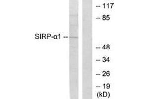 Western blot analysis of extracts from HepG2 cells, using Sirp alpha1 Antibody. (SIRPA antibody  (AA 451-500))
