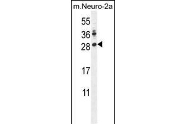 LIN28A antibody  (AA 108-138)