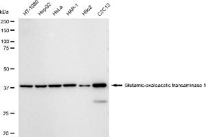Western blotting analysis using Glutamic-oxaloacetic transaminase 1 antibody (ABIN7798744).