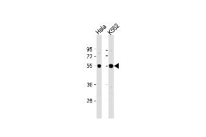 All lanes : Anti-IRAK4 Antibody (N-term) at 1:1000 dilution Lane 1: Hela whole cell lysate Lane 2: K562 whole cell lysate Lysates/proteins at 20 μg per lane. (IRAK4 antibody  (N-Term))