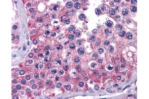 IHC-P Image Immunohistochemical analysis of paraffin-embedded human testis, using MIA3, antibody(10 μg/ml). (MIA3 antibody  (N-Term))