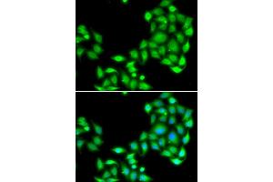 Immunofluorescence analysis of A549 cell using OGFR antibody. (OGFR antibody)