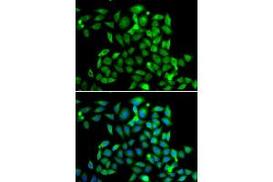 Immunofluorescence analysis of A549 cell using CLASP1 antibody. (CLASP1 antibody)