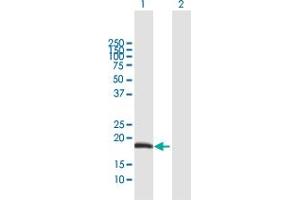 ODAM antibody  (AA 1-153)