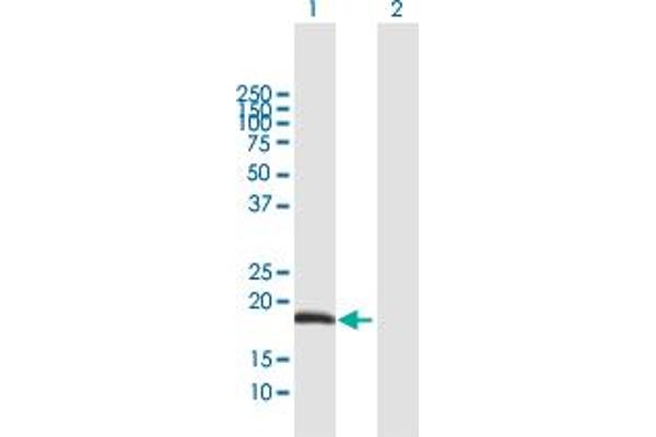 ODAM Antikörper  (AA 1-153)