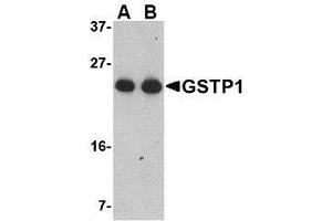 Western blot analysis of GSTP1 in Jurkat cell lysate with AP30389PU-N GSTP1 antibody at (A) 0. (GSTP1 antibody  (Center))