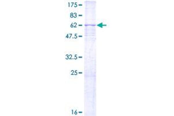 CDK7 Protein (AA 1-346) (GST tag)