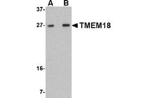 Western Blotting (WB) image for anti-Transmembrane Protein 18 (TMM18) (C-Term) antibody (ABIN1030748)