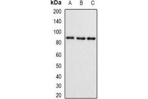 Western blot analysis of SMYD4 expression in mouse brain (A), mouse ovary (B), rat kidney (C) whole cell lysates. (SMYD4 antibody)