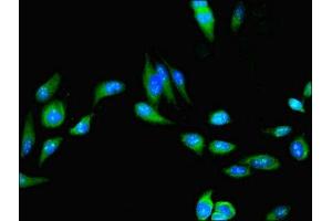Immunofluorescent analysis of Hela cells using ABIN7174670 at dilution of 1:100 and Alexa Fluor 488-congugated AffiniPure Goat Anti-Rabbit IgG(H+L) (UFSP2 antibody  (AA 63-343))