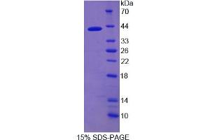 Image no. 1 for Nuclear Factor kappa B (NFkB) (AA 47-372) protein (His tag) (ABIN6236789) (NFkB Protein (AA 47-372) (His tag))