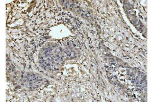 IHC analysis of EXOSC8 using anti-EXOSC8 antibody (ABIN7601850). (EXOSC8 antibody  (AA 49-216))
