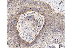 IHC analysis of RPL8 using anti-RPL8 antibody (ABIN7601179). (RPL8 antibody  (AA 3-257))