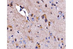 IHC analysis of ATG9A using anti-ATG9A antibody (ABIN7600676).