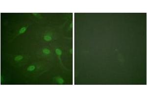 Immunofluorescence analysis of HeLa cells, using Chk1 (Phospho-Ser301) Antibody. (CHEK1 antibody  (pSer301))