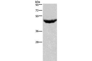 Western Blotting (WB) image for anti-Chemokine (C-X-C Motif) Receptor 2 (CXCR2) antibody (ABIN2431222) (CXCR2 antibody)