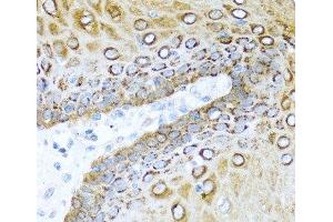 Immunohistochemistry of paraffin-embedded Human esophagus using S100A7 Polyclonal Antibody at dilution of 1:100 (40x lens). (S100A7 antibody)