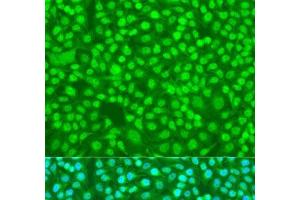 Immunofluorescence analysis of U2OS cells using SFRS9 Polyclonal Antibody at dilution of 1:100. (SFRS9 antibody)