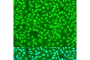 Immunofluorescence analysis of U2OS cells using SFRS9 Polyclonal Antibody at dilution of 1:100. (SFRS9 antibody)