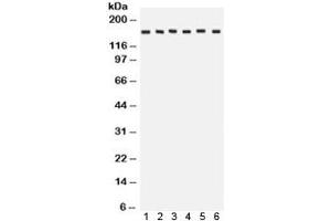 Western blot testing of 1) rat brain, 2) rat liver, 3) human HeLa, 4) CEM, 5) A549 and 6) MCF7 lysate with ROCK2 antibody. (ROCK2 antibody  (AA 652-923))