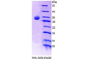 SDS-PAGE (SDS) image for Complement Component 4 Binding Protein, alpha (C4BPA) (AA 57-306) protein (His tag) (ABIN6238913)
