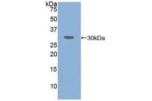 Detection of Recombinant ATXN1, Human using Polyclonal Antibody to Ataxin 1 (ATXN1) (Ataxin 1 antibody  (AA 569-807))