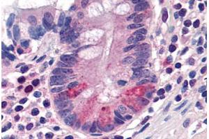 Human Small Intestine, Paneth Cells (formalin-fixed, paraffin-embedded) stained with SLC15A1 antibody ABIN290274 at 20 ug/ml followed by biotinylated goat anti-rabbit IgG secondary antibody ABIN481713, alkaline phosphatase-streptavidin and chromogen. (SLC15A1 antibody  (C-Term))