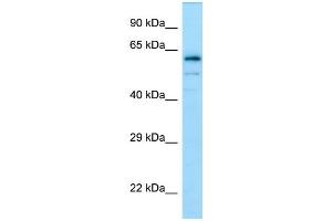 Western Blotting (WB) image for anti-Dihydropyrimidinase-Like 4 (DPYSL4) (C-Term) antibody (ABIN2790103) (DPYSL4 antibody  (C-Term))