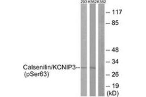 Western blot analysis of extracts from K562 cells treated with forskolin 40nM 30' and 293 cells treated with PMA 125ng/ml 30', using Calsenilin/KCNIP3 (Phospho-Ser63) Antibody.