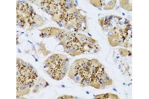 Immunohistochemistry of paraffin-embedded Human stomach using CHIC2 Polyclonal Antibody at dilution of 1:100 (40x lens).